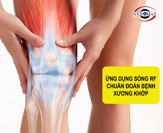 ứng dụng sóng RF chuẩn đoán xương khớp