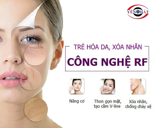 ứng dụng sóng RF lĩnh vực làm đẹp