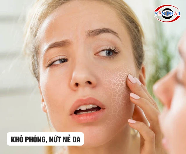 Khô da, khó chịu