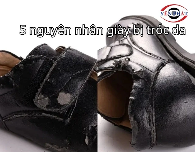 5 nguyên nhân giày bị tróc da
